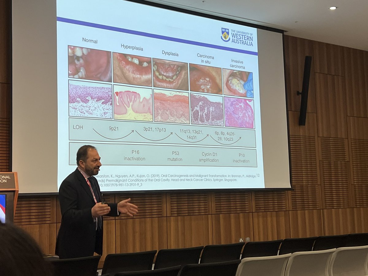 Michelle Kang (@mkangomed) on Twitter photo Update on oral potentially malignant disorders by A/Prof Omar Kujan <a href="/Omark8867/">Omar Kujan</a> at #FDI2023 Update on oral potentially malignant disorders by A/Prof Omar Kujan <a href="/Omark8867/">Omar Kujan</a> at #FDI2023