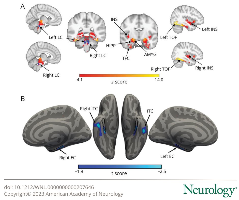 Neurology Journal tweet media
