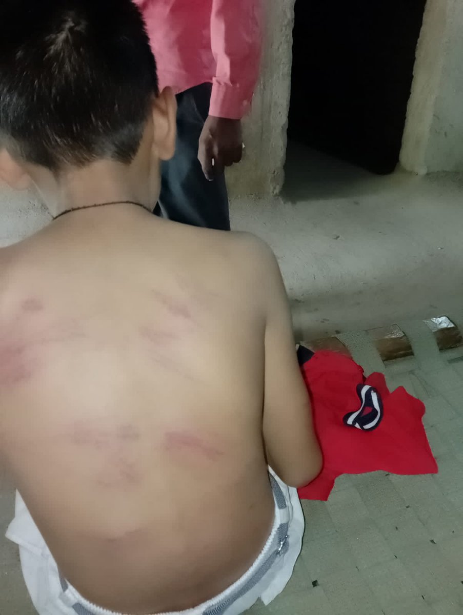 बांसवाड़ा घाटोल क्षेत्र के एक निजी शिक्षण संस्थान के हॉस्टल वार्डन द्वारा 6 कक्षा के छात्र को बेरहमी से मारपीट की गई <a href="/RajPoliceHelp/">Rajasthan Police HelpDesk</a> उक्त मामले मे संज्ञान लेकर ठोस कार्यवाही करें शिक्षण संस्था की मान्यता रद्द की जावे!!
<a href="/ashokgehlot51/">Ashok Gehlot</a>
<a href="/TADUdaipur/">Tribal Area Development Department</a>
#ज्ञान_सहायक_प्रोजेक्ट_रद्द_करों