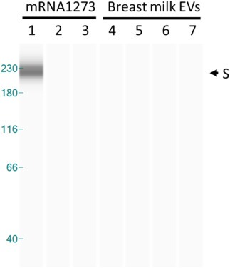 Jikkyleaks's tweet image. Er... proteome guys... 
Can anyone explain why the Automated Western Blot (AWB) in the Hanna "mRNA in breast milk" paper 
1⃣ shows a perfect band at 220kDa in the 10^-4 conc (lane 1)
2⃣ shows no other bands at all, despite the antibody being for S1 subunit
3⃣ shows no trace of a