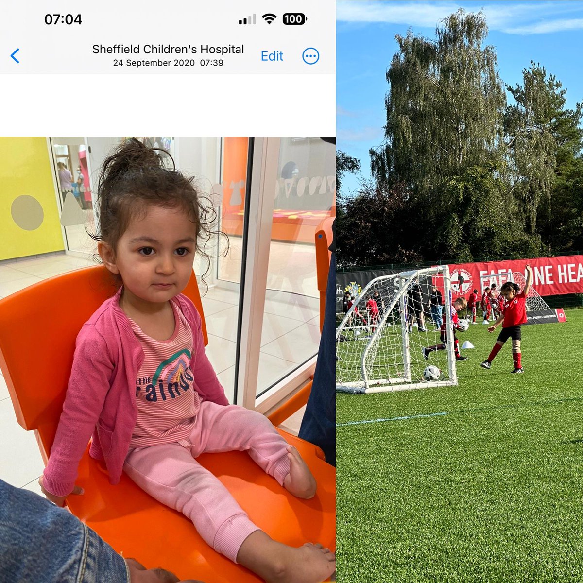 Today marks a significant milestone in Jeevna's journey. Three years ago, she underwent amputation, forever altering her life. Today, we find ourselves at the England Amputee Football Association.

What an AMAZING story! What a brave girl. #amputeefootball