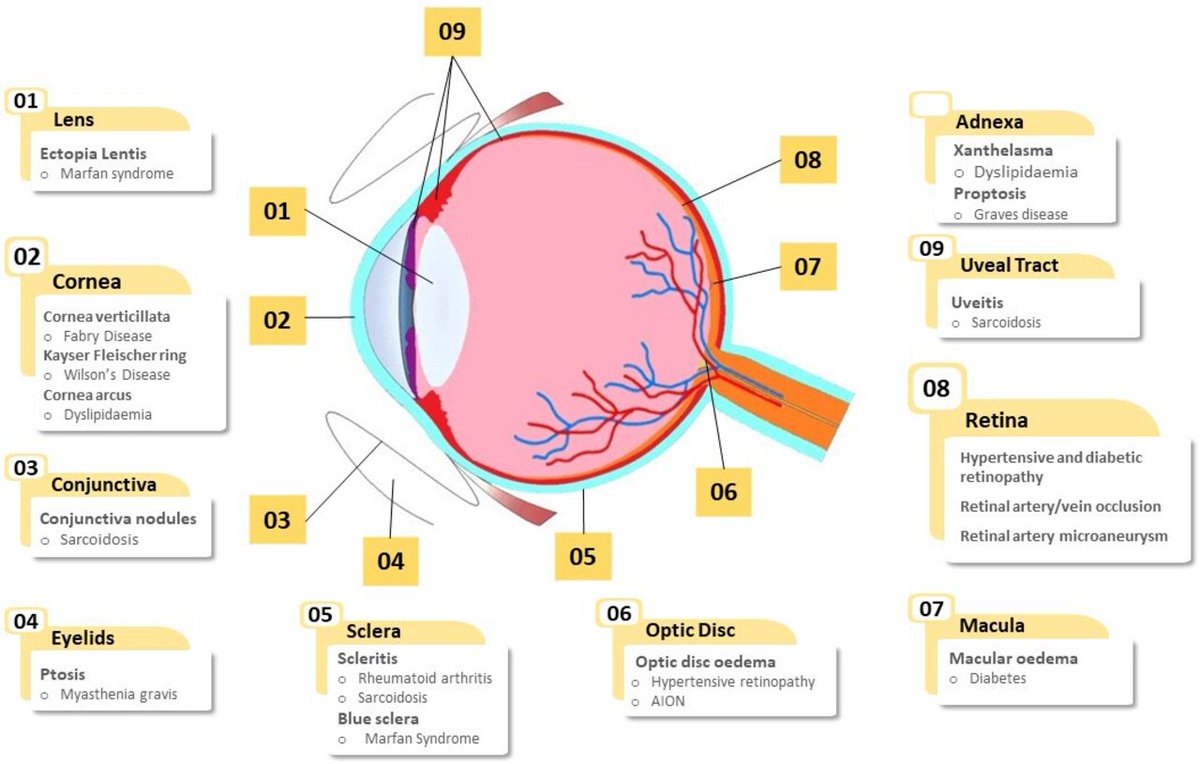 Open access - Eyes and the heart: what a clinician should know

bit.ly/3YrcvYc