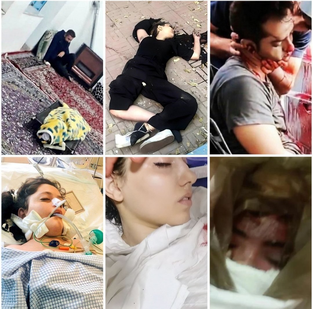 myfootkin's tweet photo. وقتی هشتگ #مهسا_‌‌‌‌‌‌‌‌‌‌‌‌‌‌‌‌‌‌‌‌‌امينی میزنیم منظورمان بیشتر از ۷۰۰کش��ه به دست جمهوری اسلامیست.
تا روزی که نفس بکشم دشمن من فقط جمهوری اسلامیست.
#زن‌_زندگی_آزادی https://t.co/IsWa2cYL89