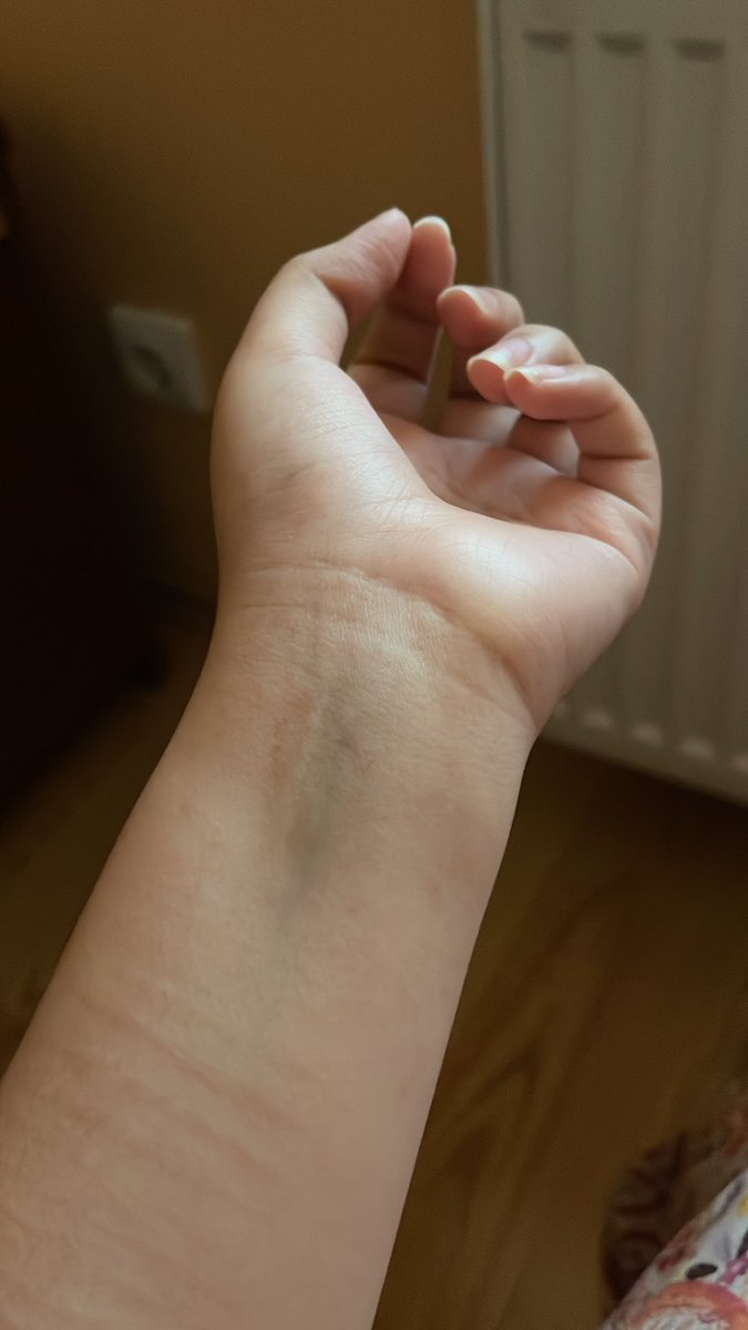 etoilebones's tweet image. guys where do i cut here so i can kms