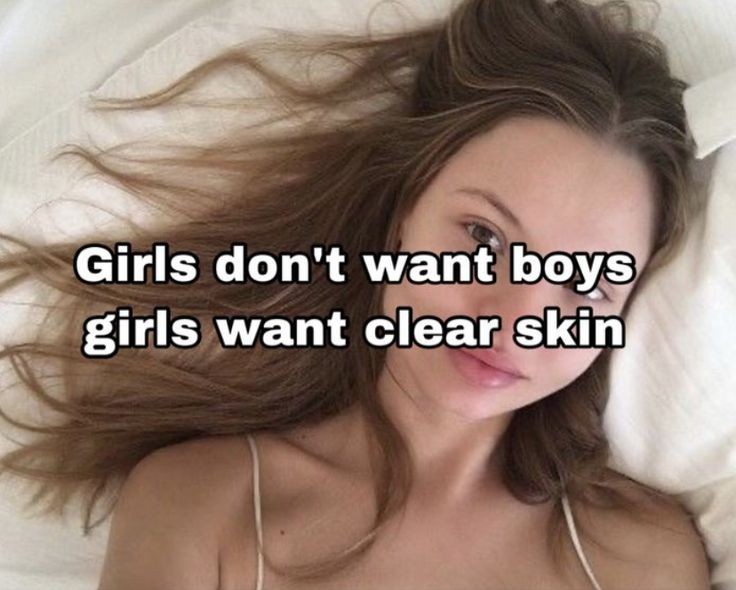 True