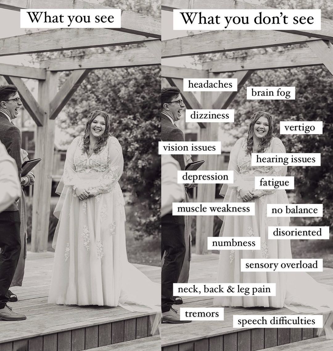 mssociety's tweet photo. "Daily reminder that you don’t always know what is going on in someone’s life and that not all illnesses and disabilities are visible. So what is it they say? In a world where you can be anything; be kind."

~Emily, @ themultiplesclerosismillennial on IG, #ThisIsMS https://t.co/2Tvp7OibRr
