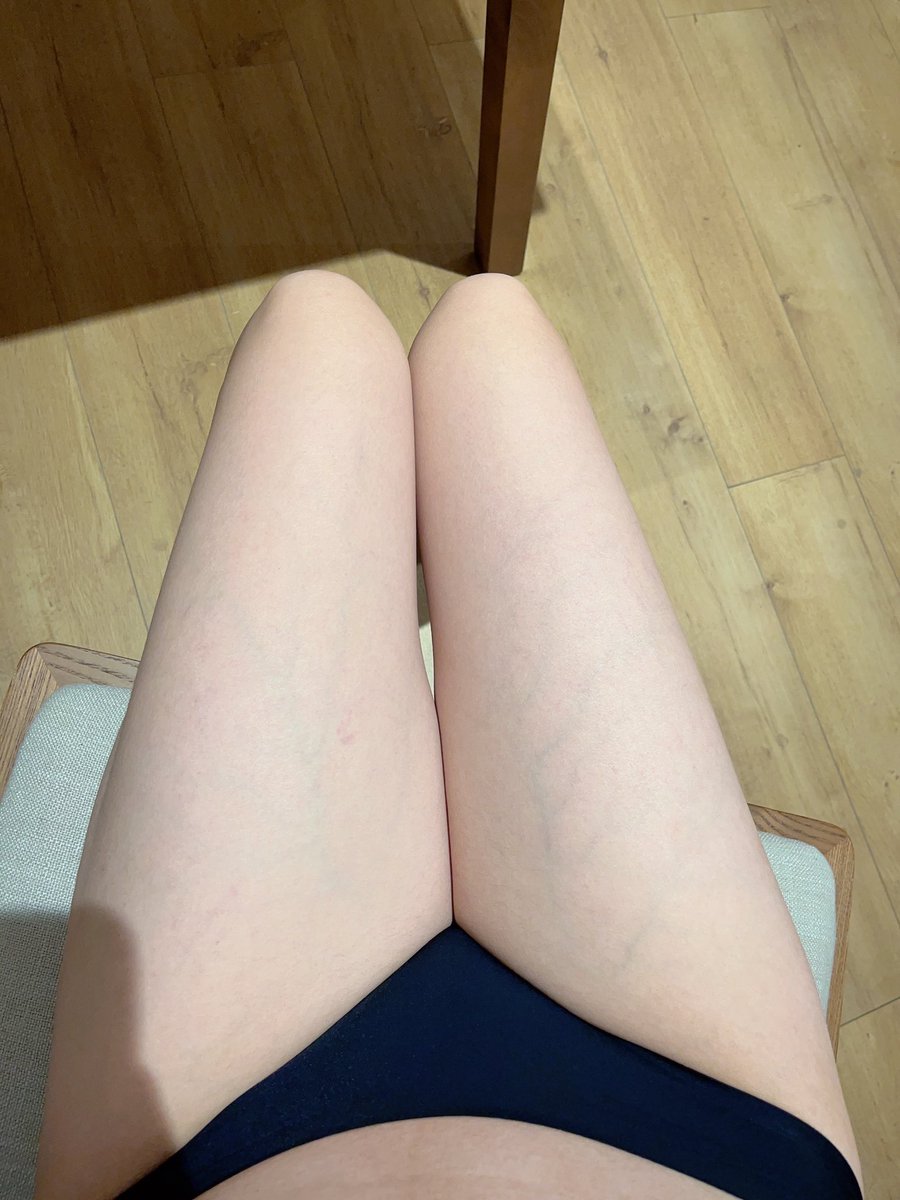 我腿真白 自己都忍不住亲一口
不过今晚的小哥哥也很白 哈哈 https://t.co/mZyj7fAo37