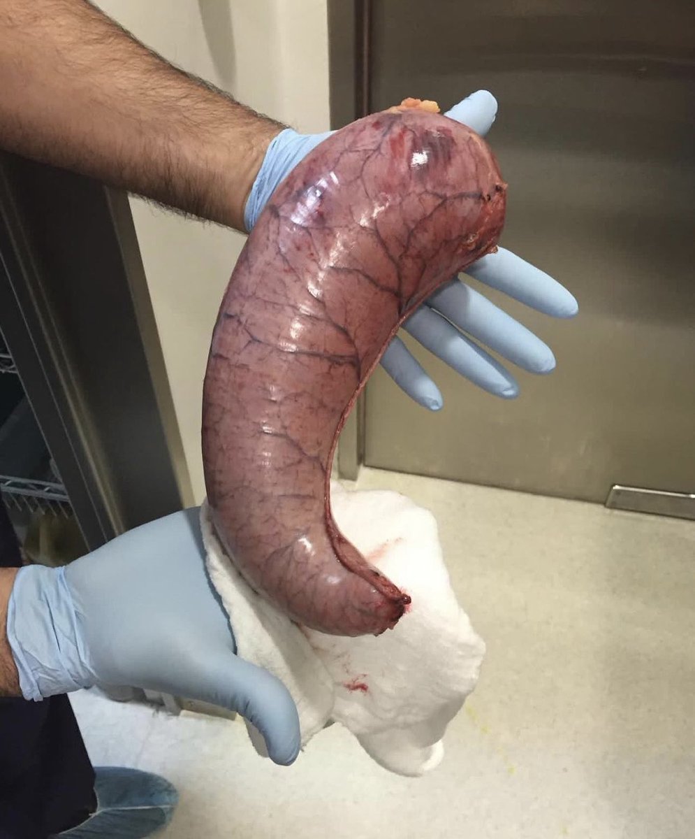 Keith Siau tweet media