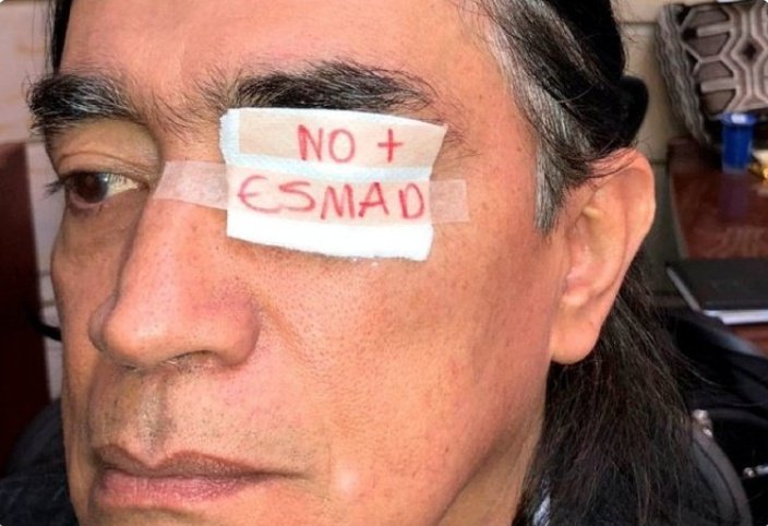 Ayer el ESMAD (que Petro prometió desmontar) le sacó el ojo derecho a un adolescente en la protesta de bicitaxistas en Patio Bonito.

¿Por qué <a href="/GustavoBolivar/">Gustavo Bolívar</a> no ha dicho nada?

¿Ya no está en contra del ESMAD?

¿Ya no defiende a los jóvenes?

¿Ya no le duelen nuestros ojos?