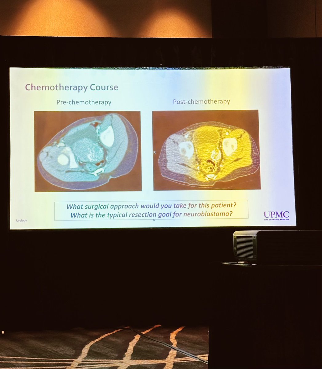 Neeta D'Souza (@neetad_souza) on Twitter photo Best part of <a href="/SPU_Urology/">SPU_Urology</a> Fall Congress, besides presenting our work, was the <a href="/PedsUroOnc/">Pediatric Urologic Oncology Working Group</a> mystery cases. Grateful to <a href="/jweave2925/">Jweave2925</a> for the opportunity to be there and <a href="/eugene_pietzak/">Eugene Pietzak</a> for giving me the lexicon to understand these complex onc cases and decision-making pathways! Best part of <a href="/SPU_Urology/">SPU_Urology</a> Fall Congress, besides presenting our work, was the <a href="/PedsUroOnc/">Pediatric Urologic Oncology Working Group</a> mystery cases. Grateful to <a href="/jweave2925/">Jweave2925</a> for the opportunity to be there and <a href="/eugene_pietzak/">Eugene Pietzak</a> for giving me the lexicon to understand these complex onc cases and decision-making pathways!