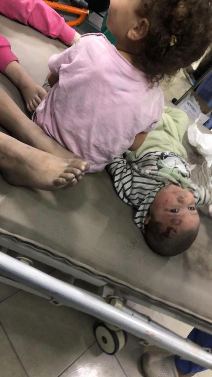EyeonPalestine's tweet photo. 🇵🇸 #Palestine || A number of Palestinian kids were injured in an Israeli air strike in Tal Azzatar north of Gaza. 9.10.23 

اصابة عدد من الأطفال في قصف الاحتلال على منطقة تل الزعتر شمال غزة https://t.co/TroxBSFEy0