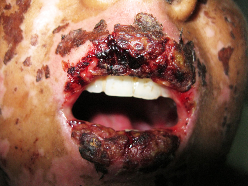 Dr Ihab Suliman tweet media