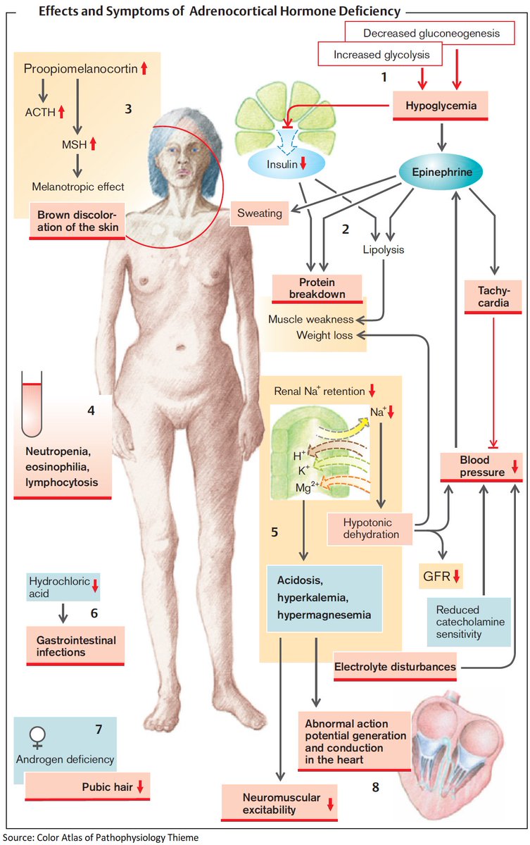 Effects and Symptoms of Adrenal Insufficiency (Addison's Disease)