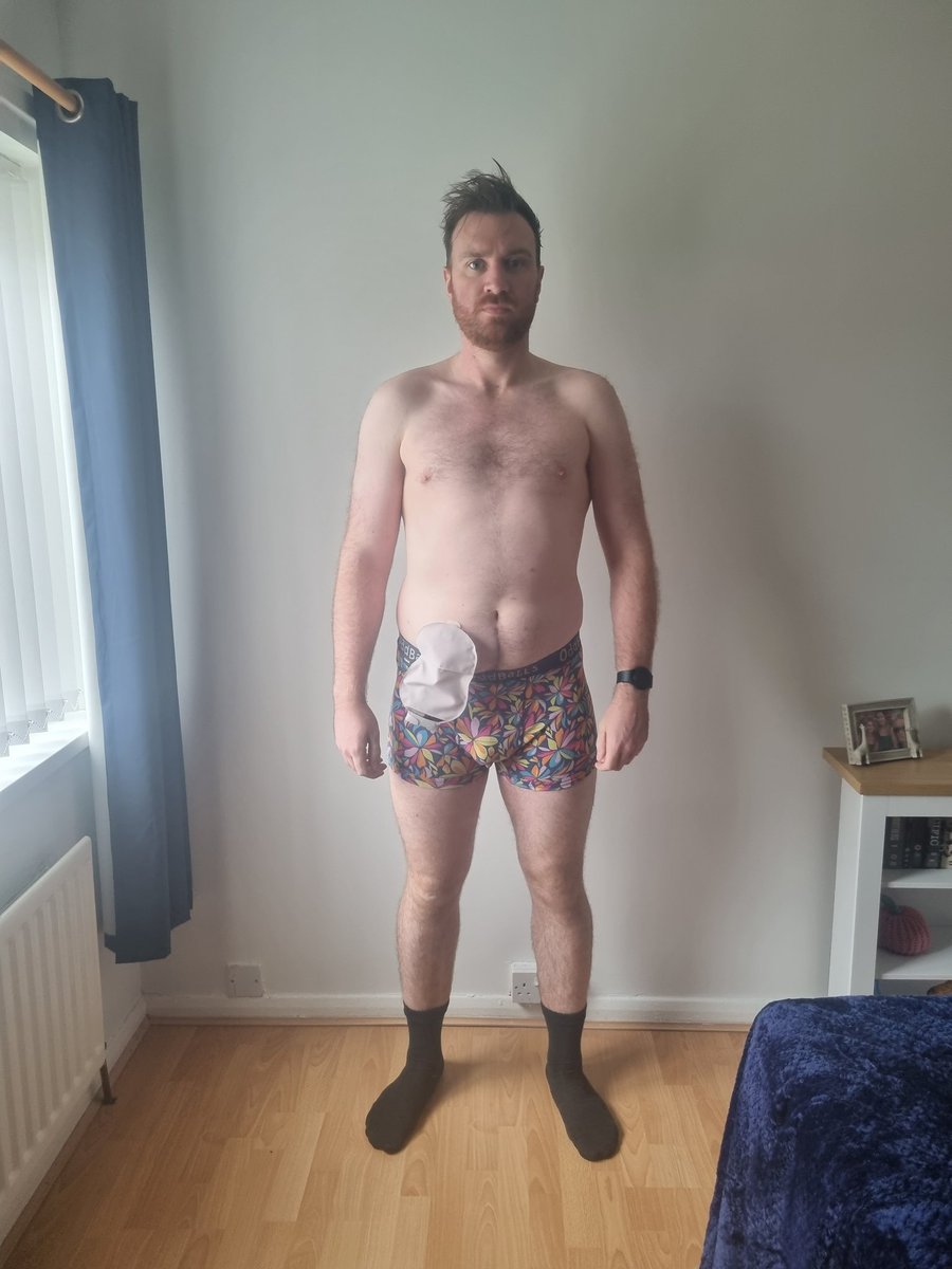 Today is #stomaawareness day, aka #ostomyawareness day. Here we are, 7.5 years since my first surgery, 4 months since my last. Back in the gym with @jbotcherbyfitness . I'm looking forward to playing rugby again next season with @teamcolostomyuk and whatever #rugbyunion