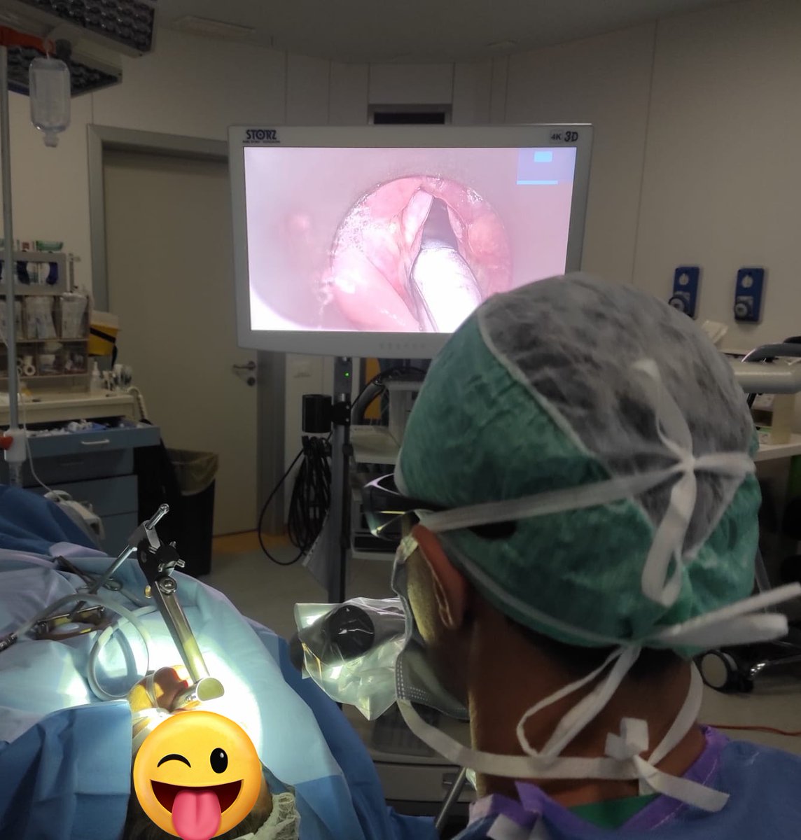 enzlorenz3's tweet photo. Yesterday was my first time using VITOM 3D 4K to perform a direct laryngoscopy to remove a false vocal fold tumor.
TOP IMAGE & VIDEO QUALITY
EASY TO USE AND HANDLE
3D!!
Looking forward to the next one!
#vitom #headandnecksurgery #directlaryngoscopy #surgery https://t.co/3wnm1nf8q7