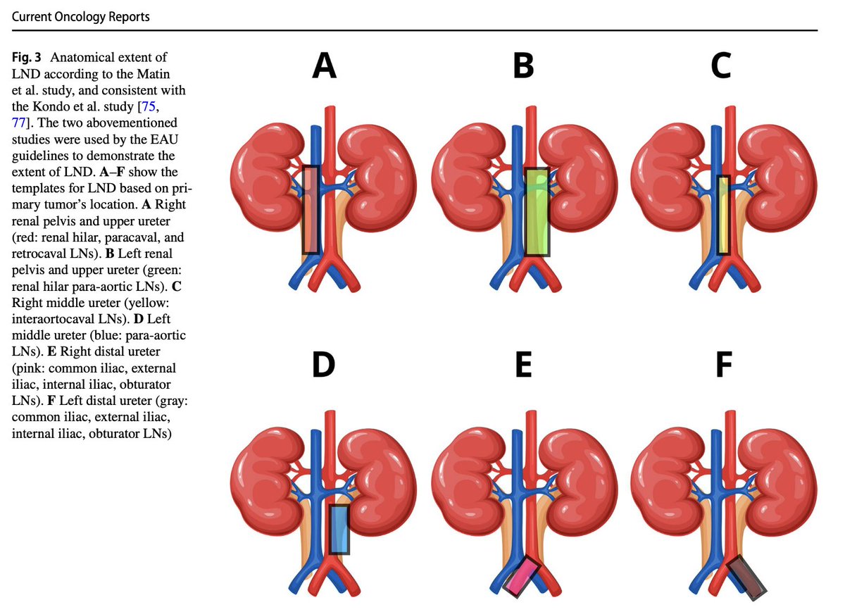 Check it out ! All about  LND in UTUC . 📚💡

Perfect resource for anyone seeking a comprehensive update on this vital topic. 🩺👏

rdcu.be/dnVZX📰

🚀 #UTUC #LymphNodeDissection