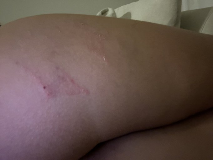 I fell completely over my plinko board on cam. Great start to my 30s 😩😂 https://t.co/IYjOBUIPfm<a href="/tag/onmfc"class="tags"><span>#onmfc</span></a>