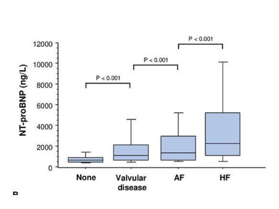 Study finds that NT pro-BNP, used in a primary care referral pathway, cannot distinguish between #heartfailure, #AtrialFibrillation or valve disease