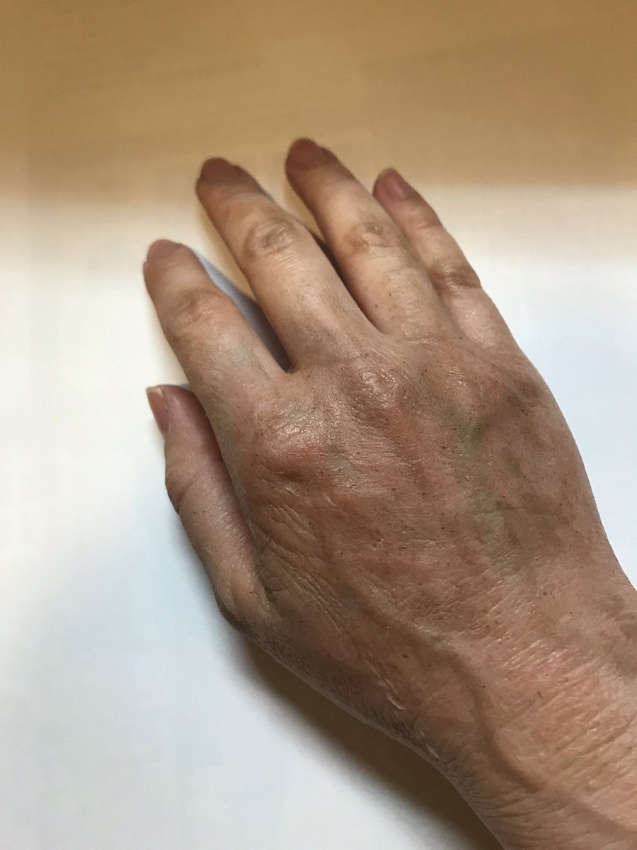Rei65246196's tweet photo. 久々に老けメイク。
シリコンのメイクパーツなぞ自宅では到底用意出来ないから、
ワックスとラテックスを駆使した力技です(2時間) https://t.co/VeYzZmT3KR