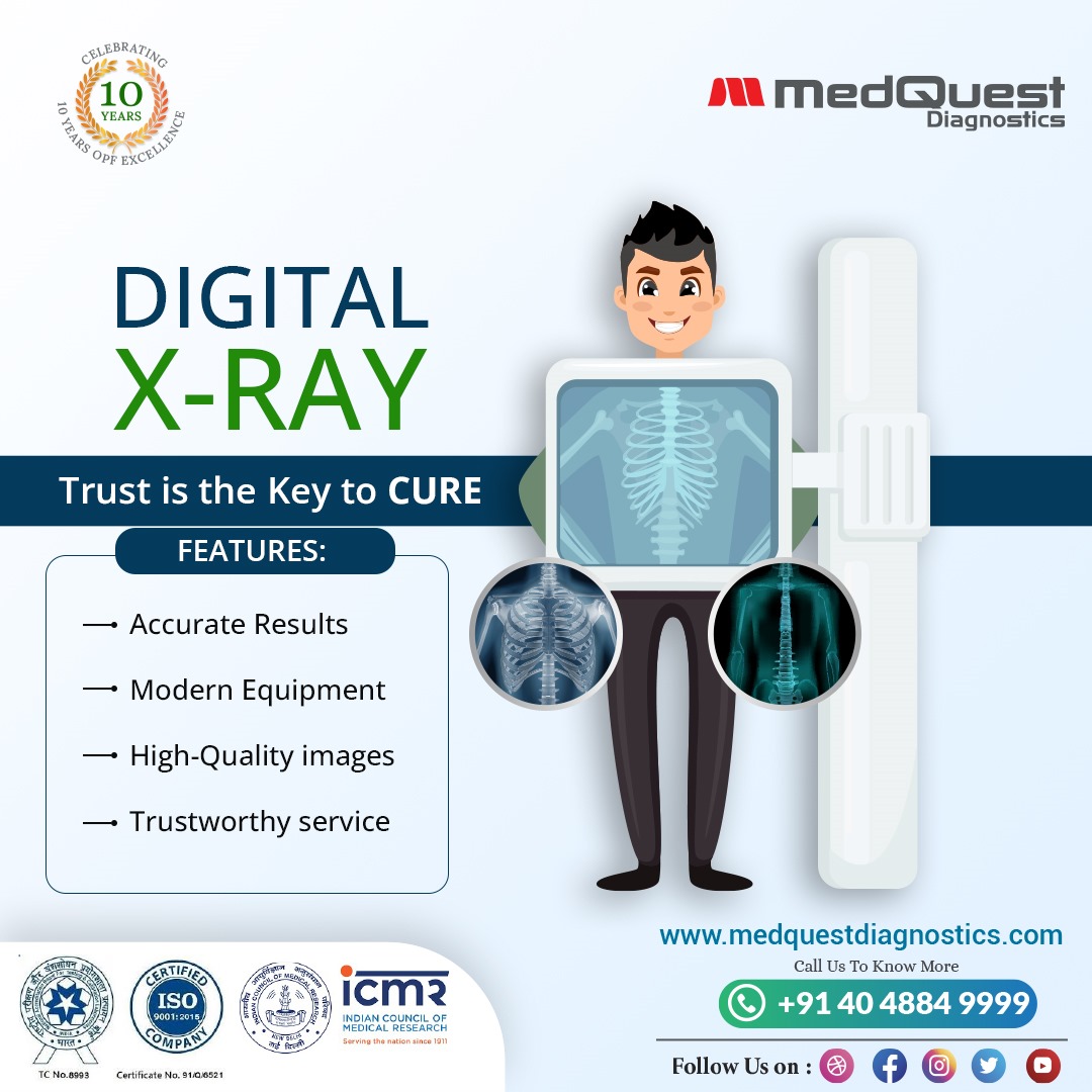 MedQuestDiagno's tweet photo. In the digital age, trust in accurate digital X-rays is vital for effective medical treatment. Your health is our priority.
Book Your Appointment Today
Call: +91 40 4884 9999
#medquestdiagnostics #hyderabad #bestdiagnosticcenterinhyderabad #DigitalXRay #MedicalImaging https://t.co/51Z1mCmNIb