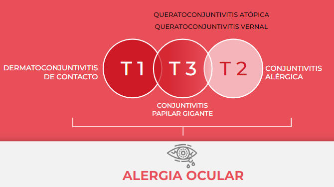 Importante‼️ nos recomiendan tener en mente que el epitelio conjuntival tiene los 3 tipos de inflamación que conocemos en otros epitelios que tanto conocemos. 
#MPL23 📲👀