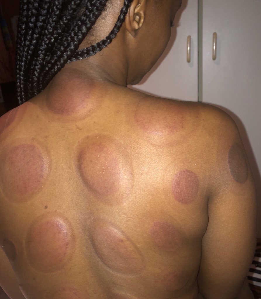 What kind massage procedure is this?