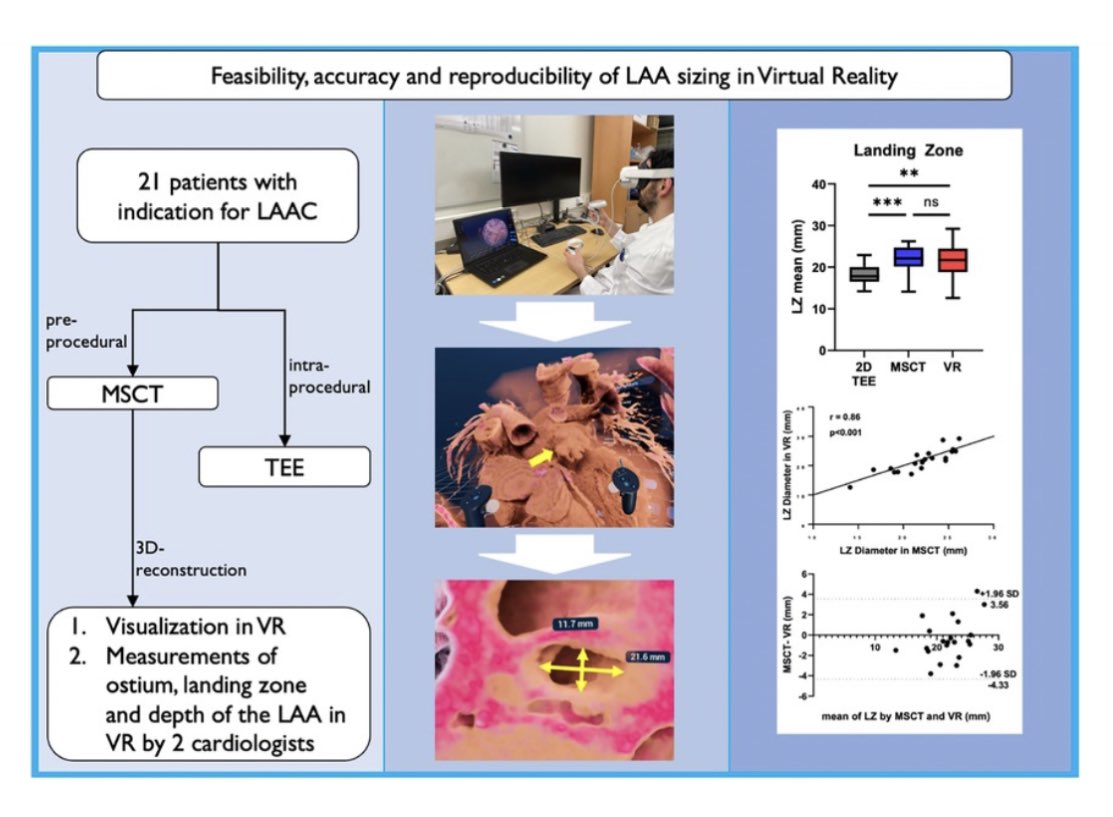 Christian Jung (@cjungmd) on Twitter photo We contribute to the next milestone in cardiovascular 🫀 care: Integration of Virtual Reality 🧑🏫👓 in #Imaging - our paper 📖 „Left atrial appendage sizing for percutaneous closure in virtual reality…“ :🔗 frontiersin.org/articles/10.33… <a href="/HHU_de/">Heinrich-Heine-Universität Düsseldorf</a> <a href="/UniklinikDUS/">Uniklinik Düsseldorf</a> @HeiCAD_HHU #CardioTwitter We contribute to the next milestone in cardiovascular 🫀 care: Integration of Virtual Reality 🧑🏫👓 in #Imaging - our paper 📖 „Left atrial appendage sizing for percutaneous closure in virtual reality…“ :🔗 frontiersin.org/articles/10.33… <a href="/HHU_de/">Heinrich-Heine-Universität Düsseldorf</a> <a href="/UniklinikDUS/">Uniklinik Düsseldorf</a> @HeiCAD_HHU #CardioTwitter