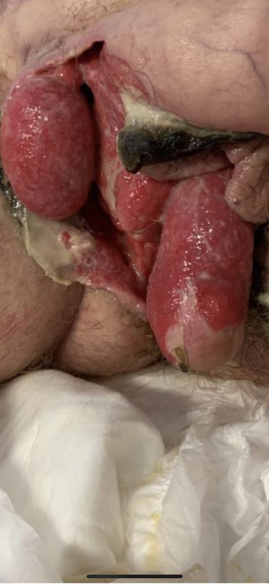 Andrea Cocci tweet media