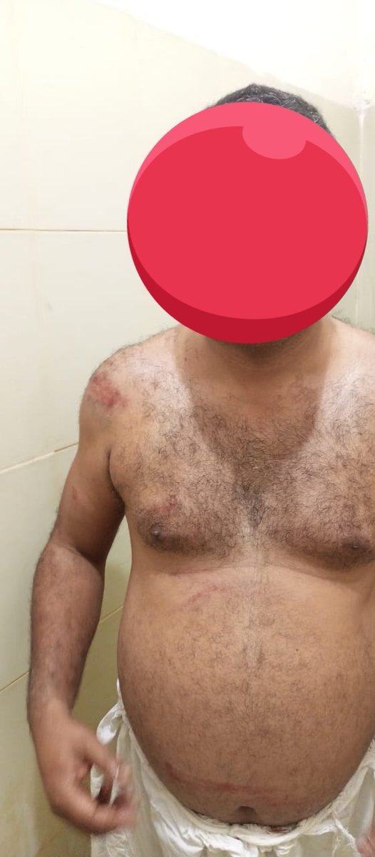 لیگ کے سابق وزیر عبد الرحمن کانجو کے سامنے پنجاب پولیس بے بس
کہروڑ پکا میں  MNA عبد الرحمن کانجو کے بھائیوں کے ہرکاروں کا سابق MS,DHQلودھراں ڈاکٹر فضل پر تشدد، تھانہ صدر پولیس نے ڈاکٹر فضل کو ہی حالات میں بند کردیا،صلح کا دباؤ ،میڈیکل بھی نہیں کرانے دیا جارہا۔