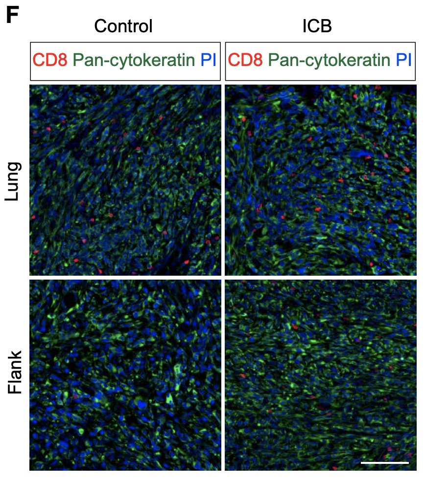 SciImmunology's tweet photo. A uniquely dysfunctional set of T cells develops early in #NSCLC and may contribute to #CheckpointBlockade resistance, according to a 2021 study in mice by @MIT researchers. https://t.co/op3leHiqfR #WeekendReads https://t.co/QoN0yhBbTN