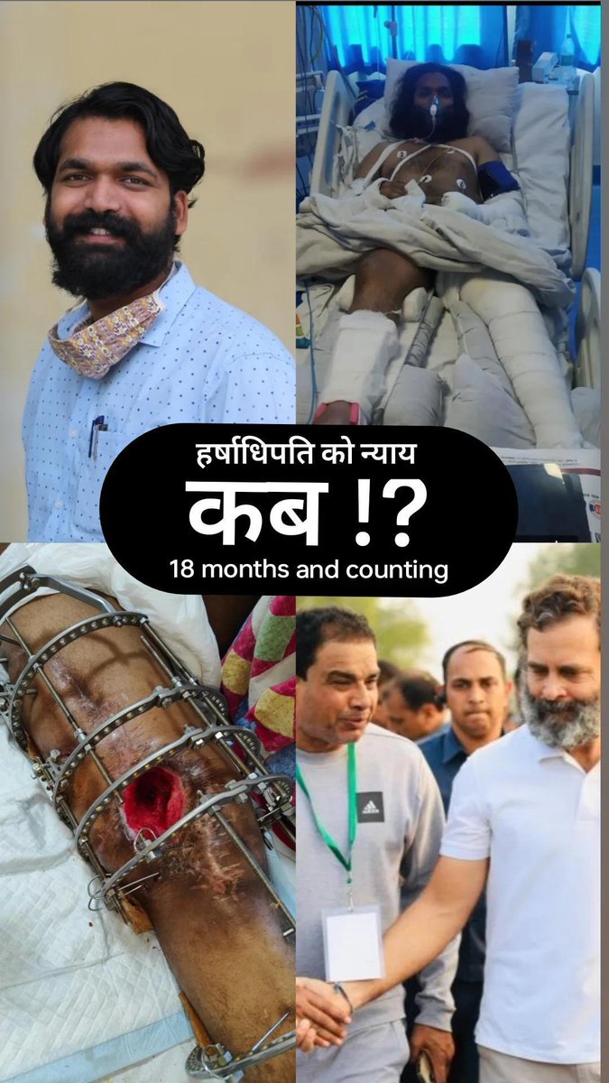 हंसता खेलता महज़ 27 साल का नौजवान एक गुंडे के अहम,ओछी मानसिकता का शिकार हुआ और विवश है अस्पताल के पलंग पर गत 18 महीनों से खड़े होने का इंतज़ार करने को।न्याय दिलवाना तो दूर उसके अपराधी संग कदमताल करते हुए दिख रहा है सिस्टम।हर्ष का कुछ दिनों में जन्मदिवस है,तोहफे में न्याय ही दे दे