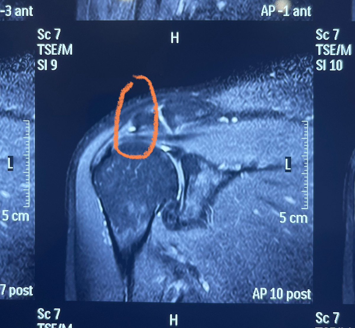 Konda Vishweshwar Reddy tweet media