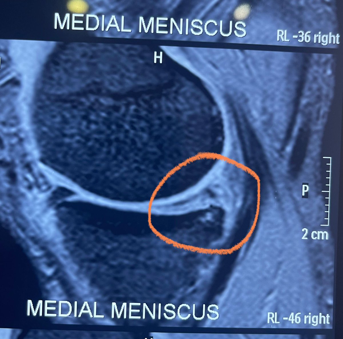 Konda Vishweshwar Reddy tweet media