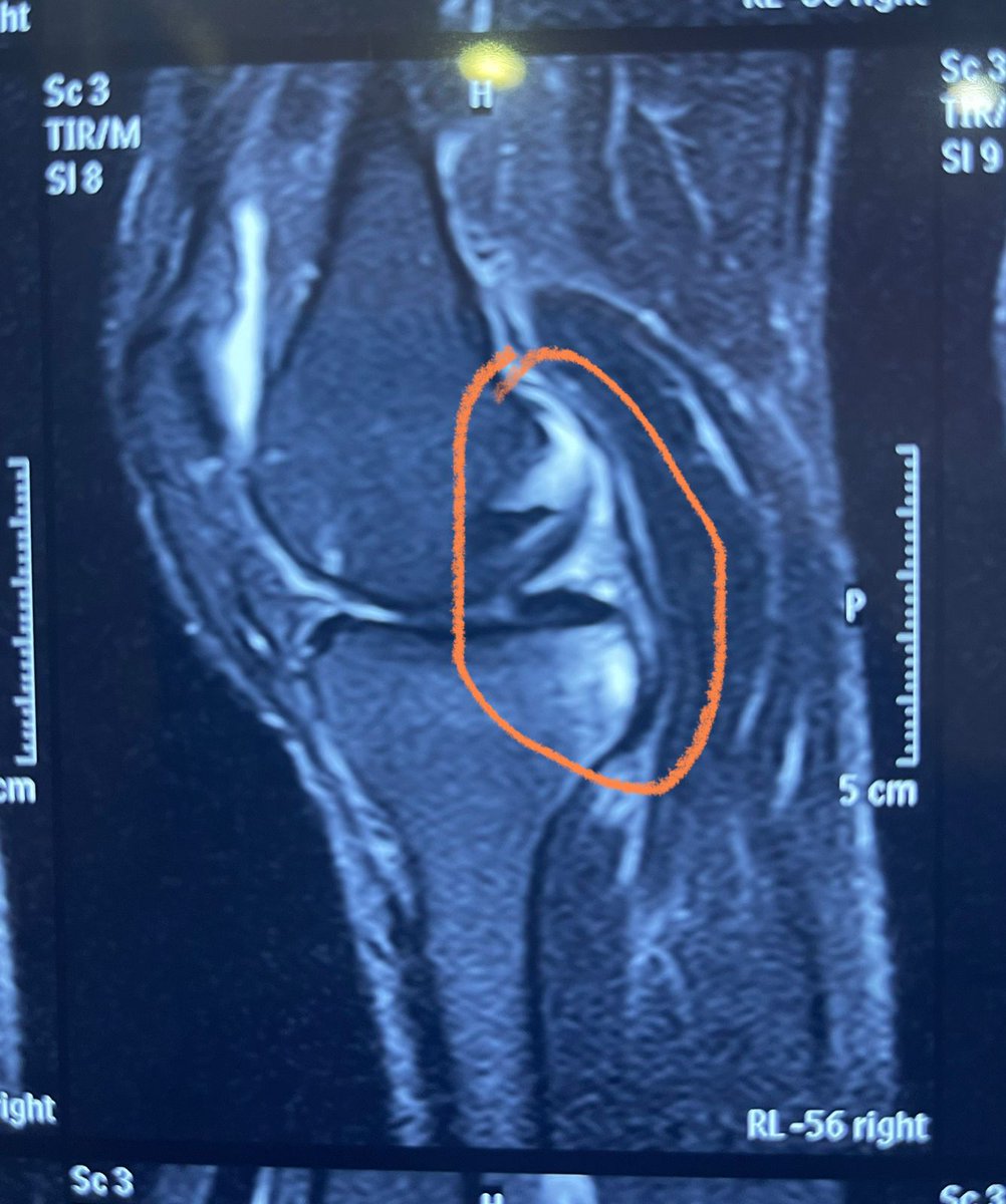 Konda Vishweshwar Reddy tweet media