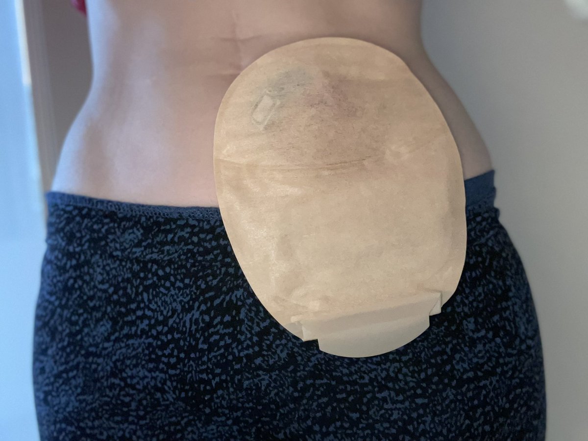 # Hello MNI Helen MBE, RGN 💙 tweet media