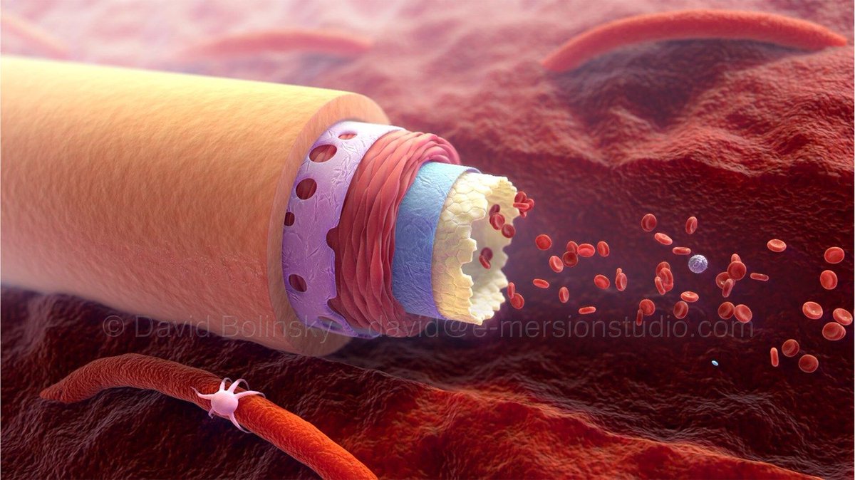 Medillustrates's tweet image. An animation still from one of a series of interactive animations created by David Bolisnky in partnership with the Frank H. Netter School of Medicine for a project called &quot;Clot Quest&quot;

Explore more of his work: buff.ly/2rPCeLF 

#circulatorysystem #3D #sciart