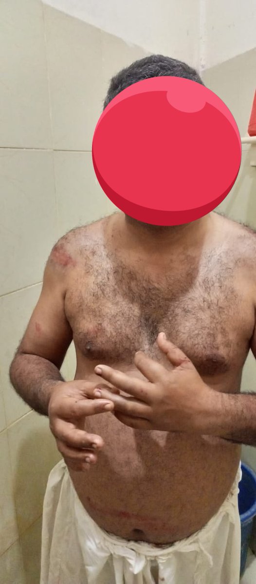 ن لیگ کے سابق وزیر عبد الرحمن کانجو کے سامنے پنجاب پولیس بے بس
کہروڑ پکا میں عبد الرحمن کانجو کے بھائیوں کے ہرکاروں کا سابق MS,DHQلودھراں ڈاکٹر فضل پر تشدد، تھانہ صدر پولیس نے ڈاکٹر فضل کو ہی حالات میں بند کردیا،صلح کا دباؤ ،میڈیکل بھی نہیں کرانے دیا جارہا۔
<a href="/OfficialDPRPP/">Punjab Police Official</a>