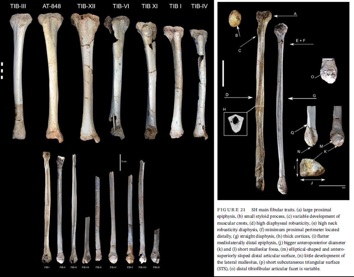 And the beautiful tibiae and fibulae from la Sima de los Huesos, #Atapuerca as well - by Laura Rodriguez and colleagues
#HumanEvolution anatomypubs.onlinelibrary.wiley.com/doi/10.1002/ar…