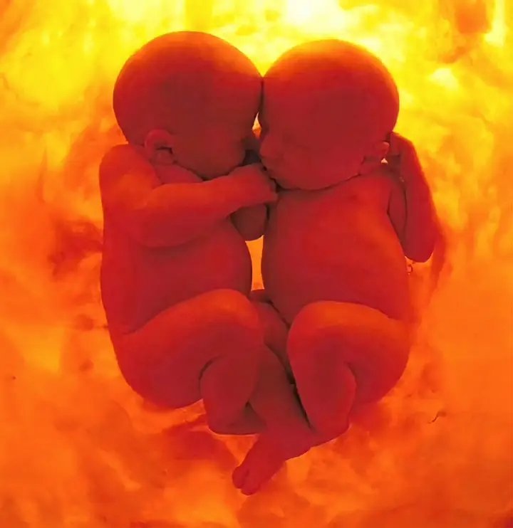 Kiinng_M_tou's tweet photo. Dans le ventre d'une mère se trouvaient deux bébés. L'un demanda à l'autre : "Crois-tu en la vie après l'accouchement ?" .... https://t.co/llMJhoPtzo