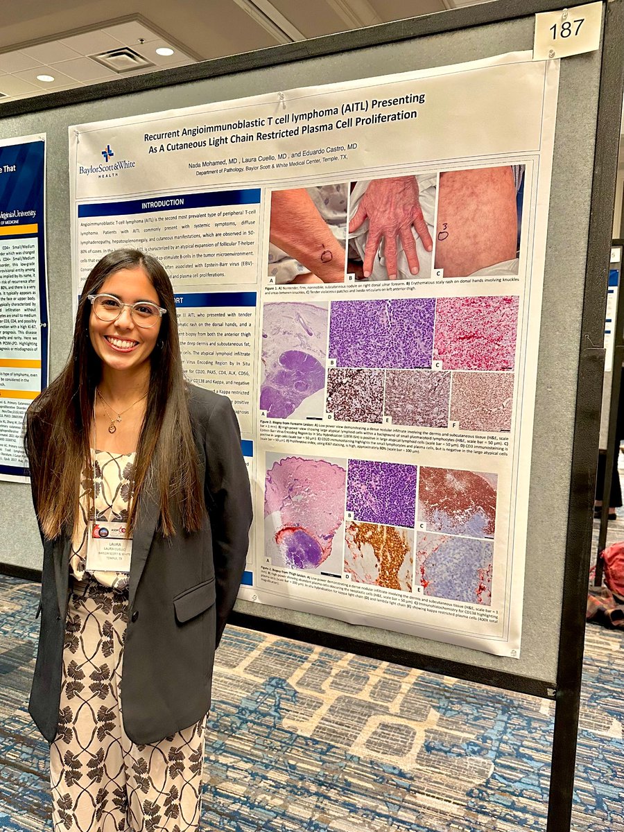LauraCuelloP's tweet photo. Thrilled to share our poster on this interesting case of AITL at the #ASDP60 ! https://t.co/Y8fkzJ9BoH