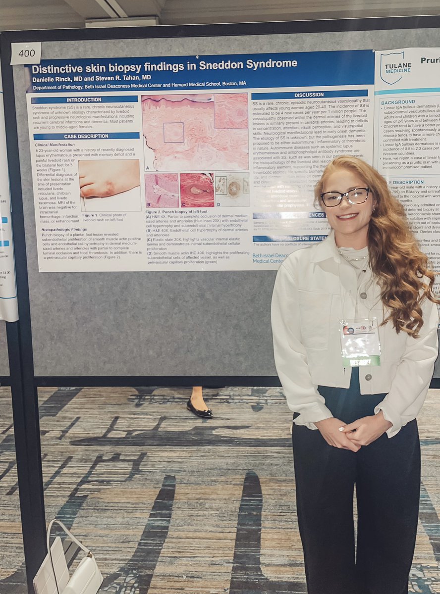 Skin doctors unite!! Having fun learning more about Dermatopathology at the annual ASDP conference #ASDP23