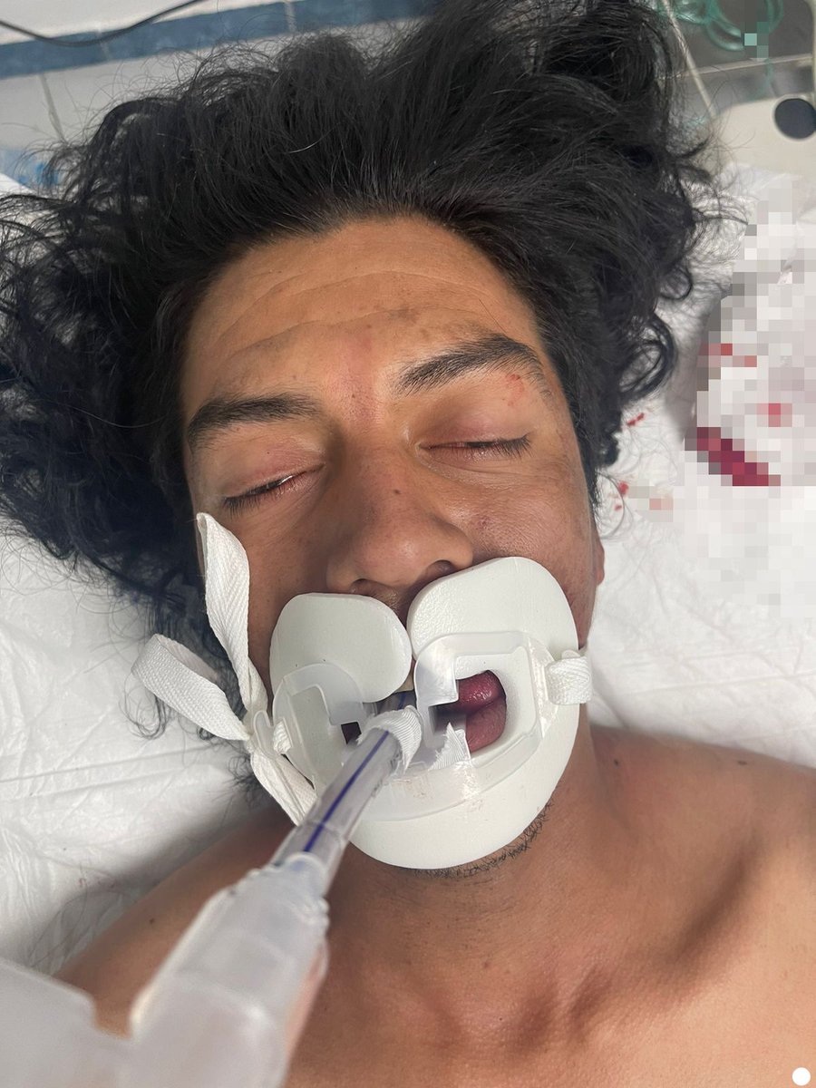 Veletti's tweet photo. Ayuda para localizar a familiares de un paciente internado en el área de urgencias en la Cruz Verde La Concha, ubicada sobre avenida Concepción al cruce con avenida Américas, en Tlajomulco. Para mayor información, comuniquense al 33 32 83 44 00 extensión 1804
#ServicioSocial https://t.co/fh9mlNrfpp