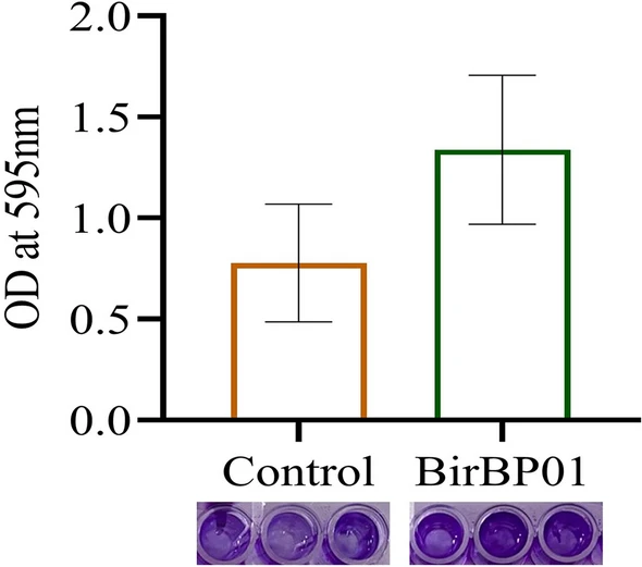 yakzaf's tweet photo. Characterization of a biofilm-forming, amylase-producing, and heavy-metal-bioremediating strain Micrococcus sp. BirBP01 isolated from oligotrophic subsurface lateritic soil
#Micrococcus #lateritic
https://t.co/BQjrFLpIBg
#ArchivesOfMicrobiology
#AliahUniversity
@avishek5banik https://t.co/8YLkMJz5Zt