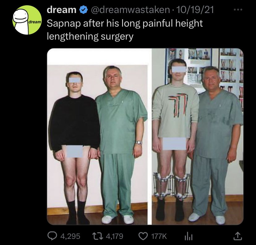 danifoundyou's tweet photo. I’m guessing George also got that surgery https://t.co/uUIySVLnWH