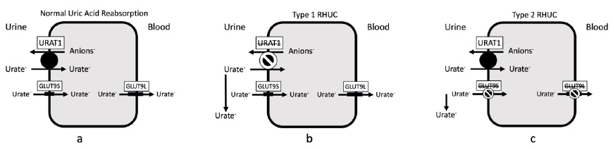 Kenar Jhaveri (@kdjhaveri) on Twitter photo Oct-Nov 2023 <a href="/KidneyNews/">ASN Kidney News</a> --<a href="/NephRodby/">Roger Rodby</a> brings <a href="/ASNKidney/">American Society of Nephrology</a> communities special case kidneynews.org/view/journals/… Unexplained, Recurrent AKI in a Young Man—It Takes a Community Oct-Nov 2023 <a href="/KidneyNews/">ASN Kidney News</a> --<a href="/NephRodby/">Roger Rodby</a> brings <a href="/ASNKidney/">American Society of Nephrology</a> communities special case kidneynews.org/view/journals/… Unexplained, Recurrent AKI in a Young Man—It Takes a Community