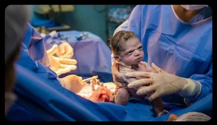 UditPrajapati10's tweet photo. When u tap on the leg of slept baby
 to check reflexes..... 

* inner he / she :- https://t.co/cw9Q9A69Nb
