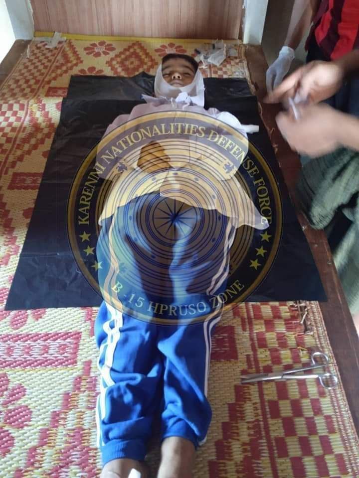 YeSoe91920267's tweet photo. The terrorist soldiers from the military training school No.14 based in #Hpruso township, fired the 4 shells to a village where locals & #IDPs live by heavy weapon at about 1:00 p.m on Oct 7, a #child of 8 was killed and the 2 homes damaged.
#2023Oct8Coup
#WhatsHappeningInMyanmar https://t.co/iJ1X0uUF6j