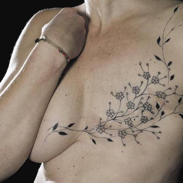 ReineDesEwokes's tweet photo. #NouvellePhotoDeProfil
#PPgame spécial #OctobreRose
Quand le tatouage vient métamorphoser la cicatrice... https://t.co/nDBkyHBJdN