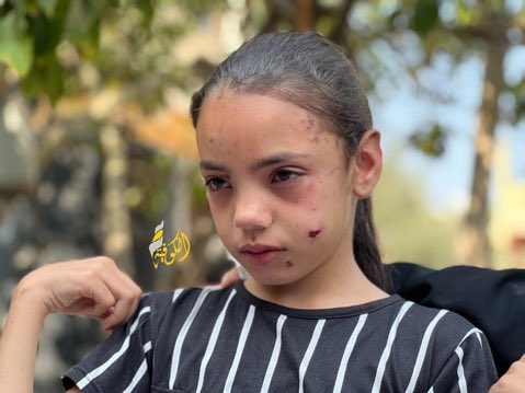 11-year-old Tala Abu Daqqa is the sole surviving member of her family after Israel bombed their home in Gaza, killing all except her.
