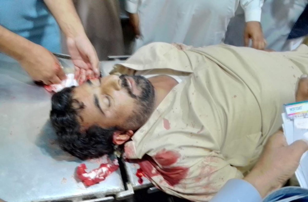 Info_Balochistn's tweet photo. Man identified as Karimullah Sasoli was killed by unknown armed men near #Jhalawan Complex #Khuzdar #Balochistan, the killed was a close relative of Former president #Khuzdar Press Club late Muhammad Khan Sasoli, https://t.co/fC26Mk9ePD
